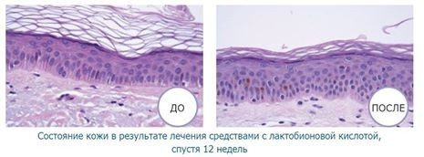 Лактобионовая кислота