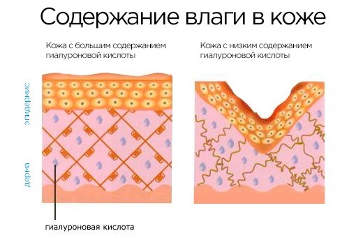 Гиалуроновая кислота в косметике